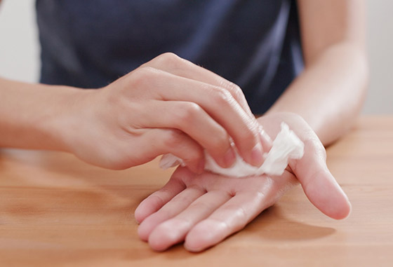أسباب تعرّق القدمين واليدين.. كيف تسيطر على هذه الظاهرة وتعالجها؟ صورة رقم 6