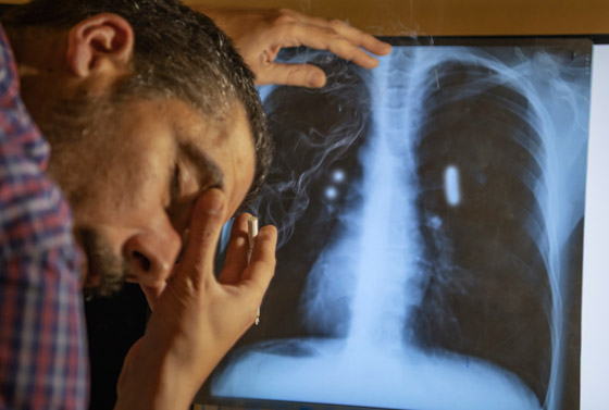 10 نصائح للإقلاع عن التدخين وتمارين وأطعمة تساعد بتطهير الرئتين صورة رقم 11