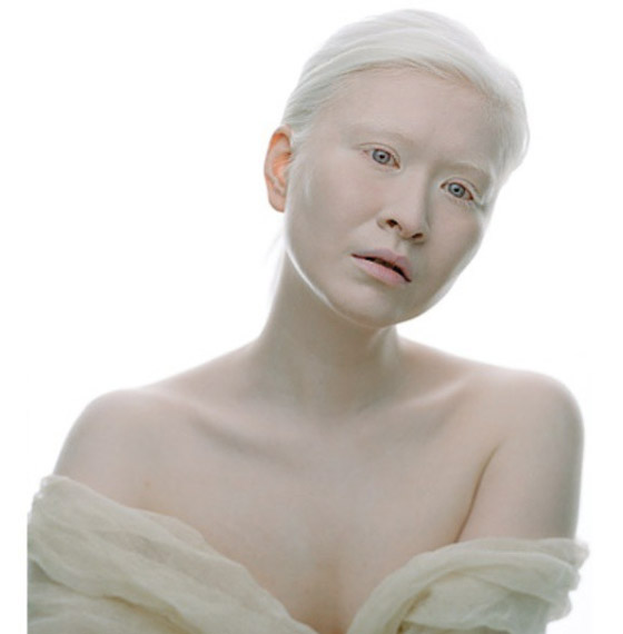 جمالهم غير طبيعي: تعرفوا إلى شخصيات تميزت بلون بشرة نادر غير مألوف صورة رقم 1