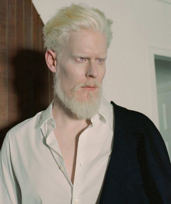 جمالهم غير طبيعي: تعرفوا إلى شخصيات تميزت بلون بشرة نادر غير مألوف صورة رقم 2