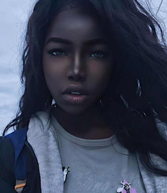 جمالهم غير طبيعي: تعرفوا إلى شخصيات تميزت بلون بشرة نادر غير مألوف صورة رقم 5