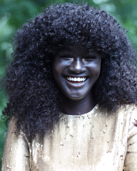 جمالهم غير طبيعي: تعرفوا إلى شخصيات تميزت بلون بشرة نادر غير مألوف صورة رقم 6