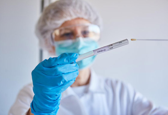 ما هي أنواع فحوصات فيروس كورونا وأيها أكثر دقة؟ صورة رقم 3