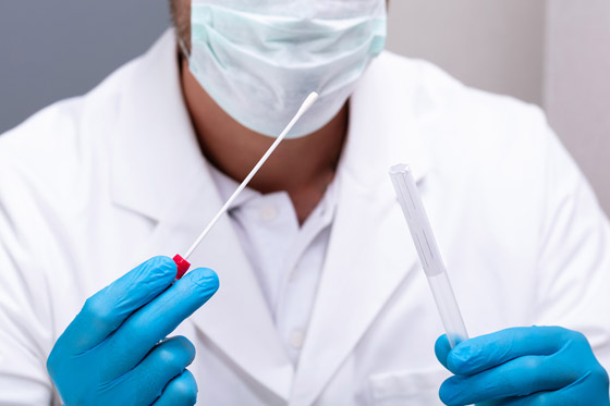 ما هي أنواع فحوصات فيروس كورونا وأيها أكثر دقة؟ صورة رقم 7