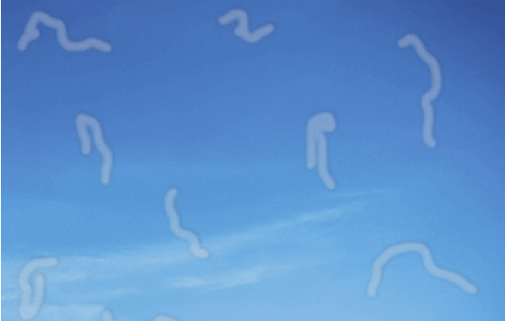 ما هي الأجسام العائمة التي نراها أحيانا ومتى تكون مؤشرا لمشاكل صحية؟ صورة رقم 2