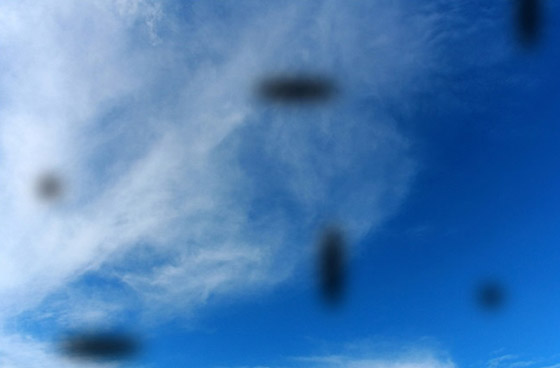 ما هي الأجسام العائمة التي نراها أحيانا ومتى تكون مؤشرا لمشاكل صحية؟ صورة رقم 4