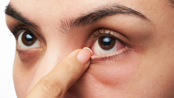 ما هي الأجسام العائمة التي نراها أحيانا ومتى تكون مؤشرا لمشاكل صحية؟ صورة رقم 6