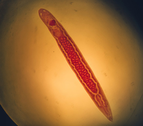 إليكم 10 أدوية وعلاجات خطيرة اعتقد الناس أنها صحية لكنها مضرة! صورة رقم 7