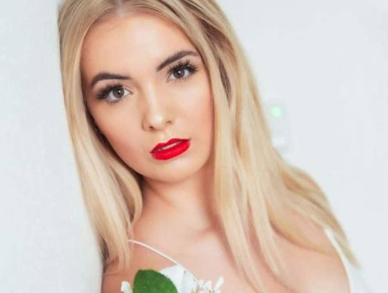 حلم فتاة سعت للقب ملكة جمال بريطانيا يتحول لكابوس يرافقها طول العمر! صورة رقم 3