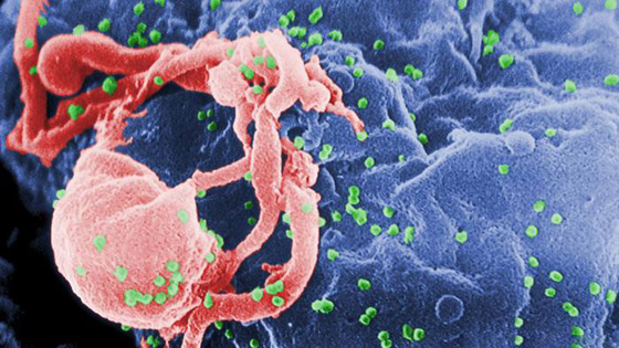 حقائق وأرقام مخيفة عن الإيدز وفيروس نقص المناعة المكتسب! صورة رقم 2