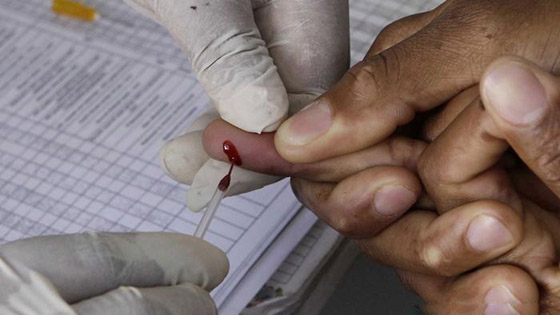 حقائق وأرقام مخيفة عن الإيدز وفيروس نقص المناعة المكتسب! صورة رقم 6