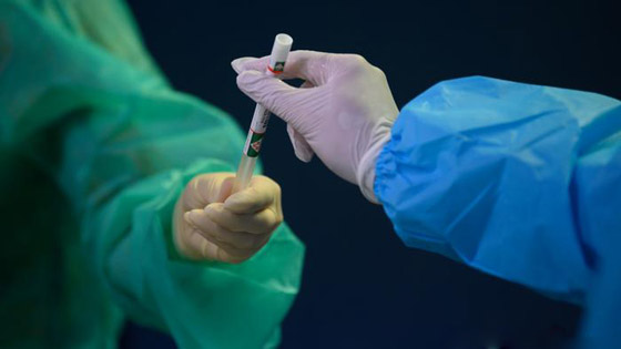 حقائق وأرقام مخيفة عن الإيدز وفيروس نقص المناعة المكتسب! صورة رقم 11