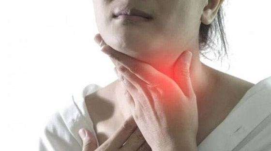 أسباب التهاب الحلق الدائم.. هذه أسبابه صورة رقم 3