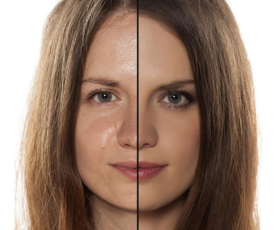 إليكم كيفية إزالة السموم من البشرة الدهنية ونصائح للعناية بها صورة رقم 1