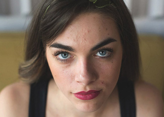 إليكم كيفية إزالة السموم من البشرة الدهنية ونصائح للعناية بها صورة رقم 3