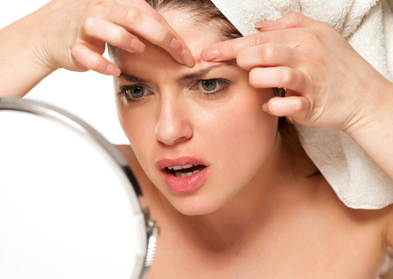 الأمر قد يبدو مقززا.. لكن هل فرقعة البثور وحب الشباب مضرة للجلد حقا؟ صورة رقم 3 الأمر قد يبدو مقززا.. لكن هل فرقعة البثور وحب الشباب مضرة للجلد حقا؟ صورة رقم 3