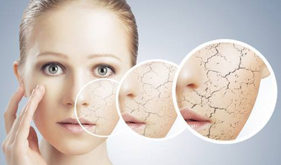 البشرة الحساسة في فصل الشتاء.. دليل كامل للعناية بها! صورة رقم 1 البشرة الحساسة في فصل الشتاء.. دليل كامل للعناية بها! صورة رقم 1