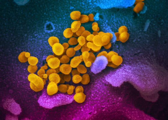 إلى أي مدى يجب أن نقلق بشأن النسخة الجديدة لفيروس كورونا؟ صورة رقم 7 إلى أي مدى يجب أن نقلق بشأن النسخة الجديدة لفيروس كورونا؟ صورة رقم 7