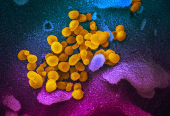 صدمة من بريطانيا: سلالة فيروس كورونا الجديدة خرجت عن السيطرة! صورة رقم 4 صدمة من بريطانيا: سلالة فيروس كورونا الجديدة خرجت عن السيطرة! صورة رقم 4