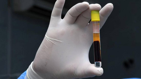 أسرار المناعة من كورونا.. هؤلاء تصعب إصابتهم بالفيروس صورة رقم 2