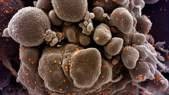 سلالة كورونا الجديدة: كيف تحدث الطفرات في الفيروسات ولماذا؟ صورة رقم 8