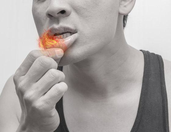 ما الذي يسبب تقرحات الفم واللسان المؤلمة وما علاجها؟ صورة رقم 1