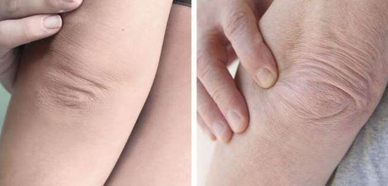 تعرفوا إلى 7 أجزاء في الجسم تكشف عن التقدم في العمر..! صورة رقم 3 تعرفوا إلى 7 أجزاء في الجسم تكشف عن التقدم في العمر..! صورة رقم 3