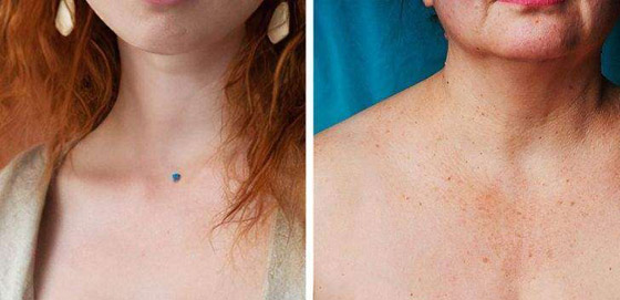 تعرفوا إلى 7 أجزاء في الجسم تكشف عن التقدم في العمر..! صورة رقم 4 تعرفوا إلى 7 أجزاء في الجسم تكشف عن التقدم في العمر..! صورة رقم 4