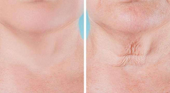 تعرفوا إلى 7 أجزاء في الجسم تكشف عن التقدم في العمر..! صورة رقم 5 تعرفوا إلى 7 أجزاء في الجسم تكشف عن التقدم في العمر..! صورة رقم 5