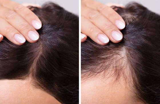 تعرفوا إلى 7 أجزاء في الجسم تكشف عن التقدم في العمر..! صورة رقم 6 تعرفوا إلى 7 أجزاء في الجسم تكشف عن التقدم في العمر..! صورة رقم 6