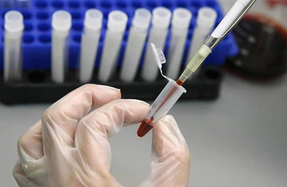 المرض إكس: التحذير من عدوى جديدة قاتلة أسرع انتشارا وأكثر فتكا من كورونا صورة رقم 9