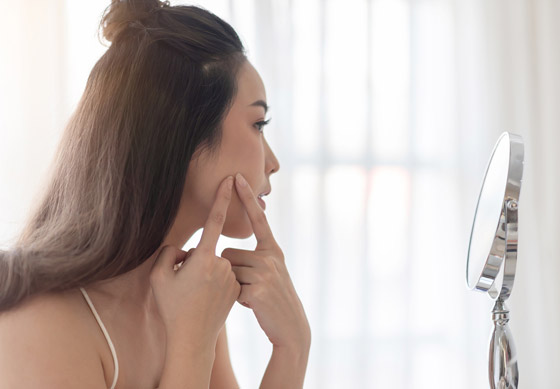 تعاني من بثور الوجه؟ إليك الدليل الشامل لأنواعها وأسبابها وعلاجاتها صورة رقم 2