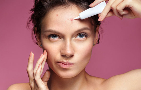 تعاني من بثور الوجه؟ إليك الدليل الشامل لأنواعها وأسبابها وعلاجاتها صورة رقم 1