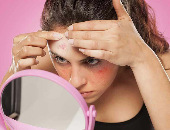 تعاني من بثور الوجه؟ إليك الدليل الشامل لأنواعها وأسبابها وعلاجاتها صورة رقم 4