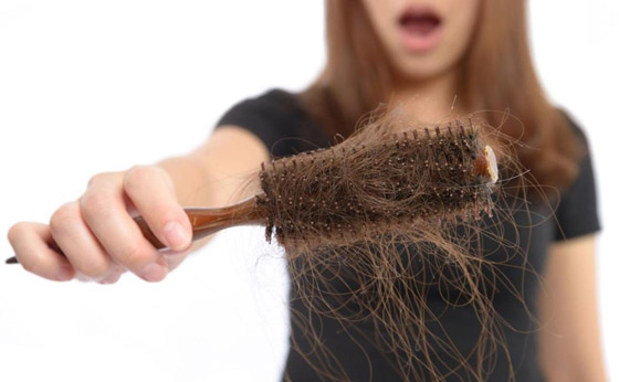 بينها الولادة وأدوات التصفيف.. إليك 10 أسباب لا تعرفها لتساقط الشعر صورة رقم 1