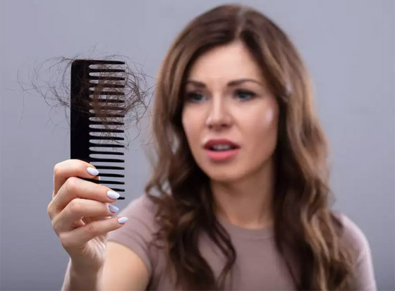 بينها الولادة وأدوات التصفيف.. إليك 10 أسباب لا تعرفها لتساقط الشعر صورة رقم 3