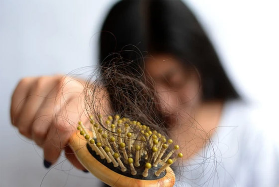 بينها الولادة وأدوات التصفيف.. إليك 10 أسباب لا تعرفها لتساقط الشعر صورة رقم 4