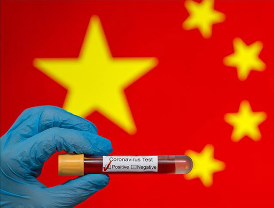 سؤال الساعة بشأن الصين.. ماذا يمنع ظهور وباء جديد أكثر فتكا من كورونا؟ صورة رقم 1