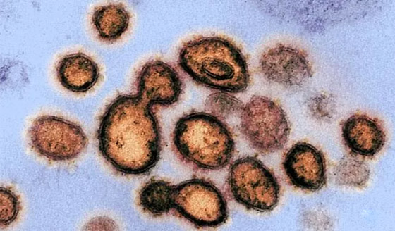 بشرة خير أخيرا.. ثغرة قد تعطّل فيروس كورونا! صورة رقم 8