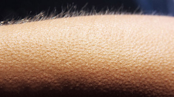 قشعريرة البرد بعد الأكل.. هل عليكم القلق بشأن هذا الشعور؟ صورة رقم 2 قشعريرة البرد بعد الأكل.. هل عليكم القلق بشأن هذا الشعور؟ صورة رقم 2