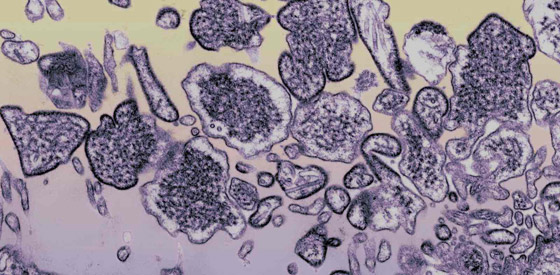 يؤدي للغيبوبة خلال 48 ساعة.. تحذيرات من فيروس نيباه الخطير! صورة رقم 14