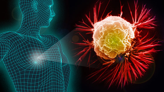 في اليوم العالمي للسرطان.. ما أسبابه وكيف تحمي نفسك من المرض القاتل؟ صورة رقم 17