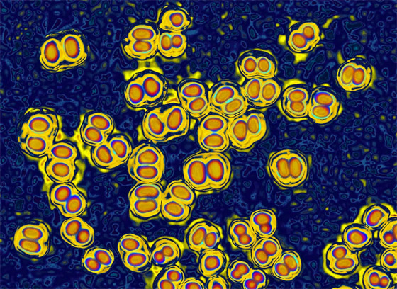 هل يمكن أن تنقل العدوى للآخرين حتى بعد تلقيك لقاح فيروس كورونا؟ صورة رقم 4