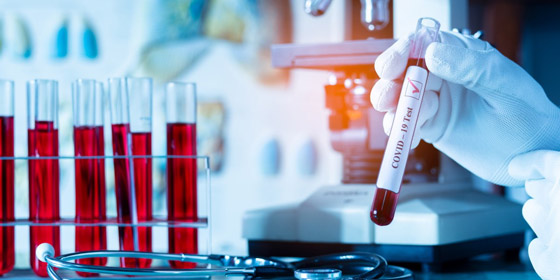 منظمة الصحة العالمية تستبعد تسرب فيروس كورونا من مختبر ووهان! صورة رقم 8