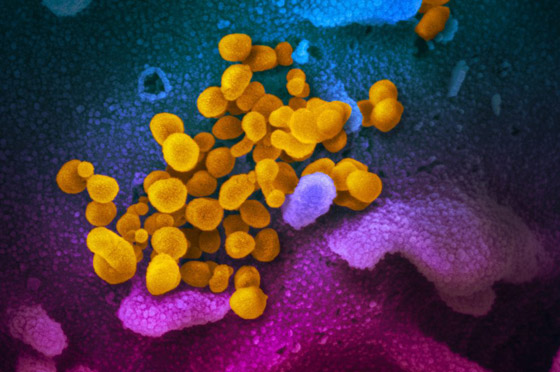 سلالة فيروس كورونا الجديدة المكتشفة ببريطانيا بطريقها لاكتساح العالم! صورة رقم 5