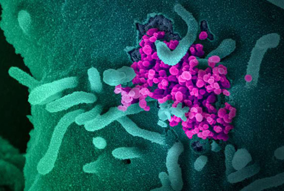 سلالة فيروس كورونا الجديدة المكتشفة ببريطانيا بطريقها لاكتساح العالم! صورة رقم 7