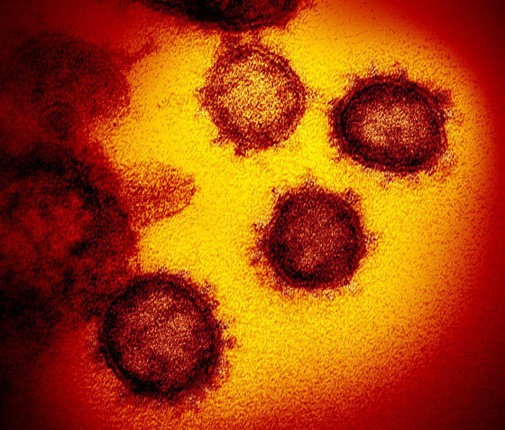 كورونا ودرجة الحرارة.. هل يكبح الصيف انتشار الفيروس؟ صورة رقم 3