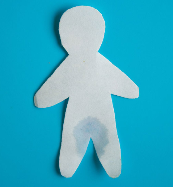 إليكم كل ما تريدون معرفته عن أعراض وأسباب أمراض المثانة المتعددة صورة رقم 4