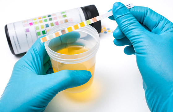 إليكم كل ما تريدون معرفته عن أعراض وأسباب أمراض المثانة المتعددة صورة رقم 18