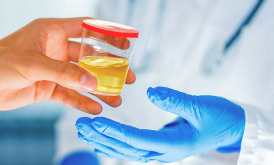 إليكم كل ما تريدون معرفته عن أعراض وأسباب أمراض المثانة المتعددة صورة رقم 21